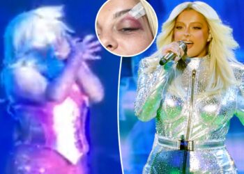 Bebe Rexha shows off black eye after fan chucks phone at her
