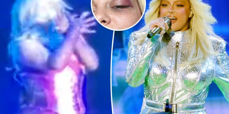 Bebe Rexha shows off black eye after fan chucks phone at her