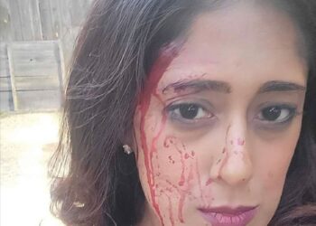 Shivanthi Sathanandan bloodied face