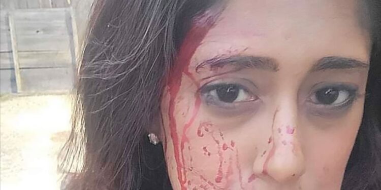 Shivanthi Sathanandan bloodied face
