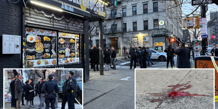 Man shot in back of head, clinging to life, in broad-daylight NYC violence: cops