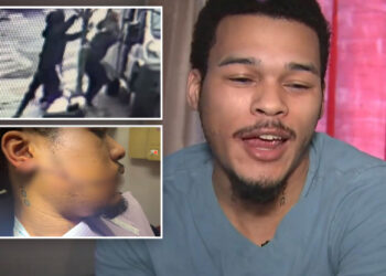 NYC Amazon worker needs 110 stitches after unprovoked slashing