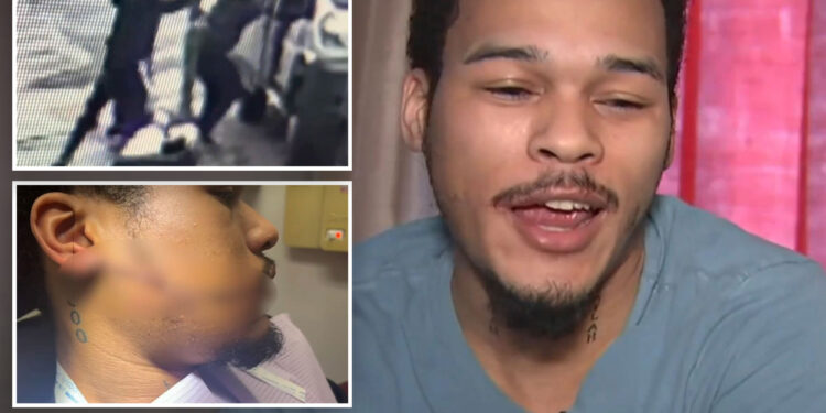 NYC Amazon worker needs 110 stitches after unprovoked slashing