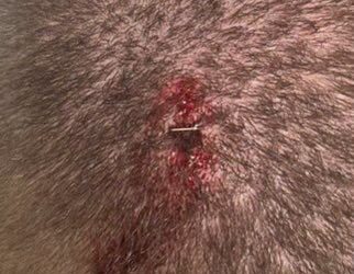 The officer was assaulted at the end of the Saturday demonstration, suffering a cut that required two staples.