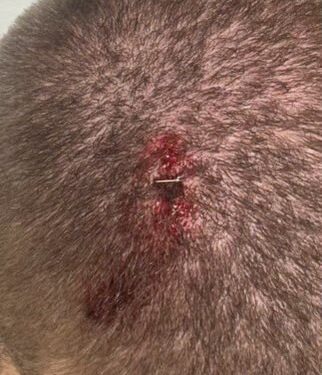 The officer was assaulted at the end of the Saturday demonstration, suffering a cut that required two staples.