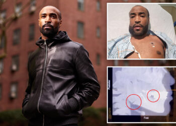 Model Adam Byrd left with broken jaw from brutal robbery outside swanky NYC lounge claims security just watched the attack