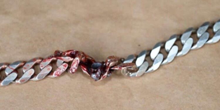 Police from Commerce said the braided metal necklace was the only thing between the man and his maker when he was shot at following an argument with another man on Tuesday.