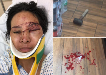 Mom left bloodied and bruised after sledgehammer attack at Bronx bodega