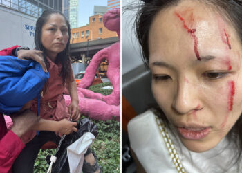 Woman's disturbing account of random attack with umbrella outside NYC eatery goes viral: 'Why me?'