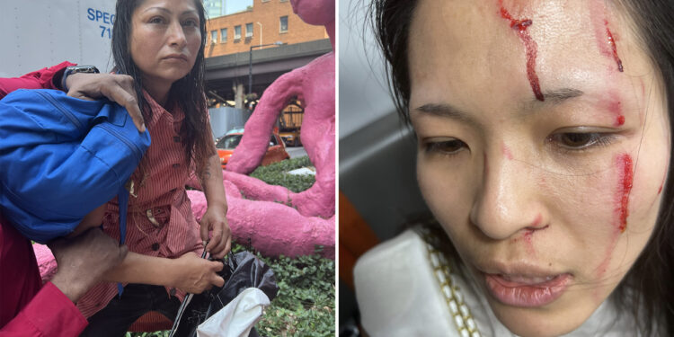 Woman's disturbing account of random attack with umbrella outside NYC eatery goes viral: 'Why me?'