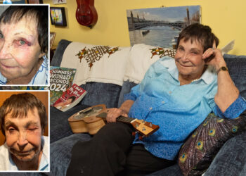 World's oldest female comedian D'yan Forest -- nearly 90 -- sucker-punched in random NYC attack: cops