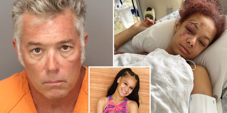 Florida man out on bail for pistol-whipping son laughed as he ran down woman during road rage incident: reports