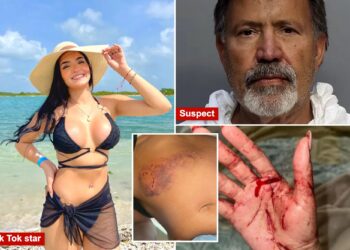 TikTok star Eixchel Berroteran shares gruesome details of attack after stepfather allegedly tried to murder her and her mother