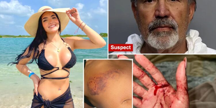 TikTok star Eixchel Berroteran shares gruesome details of attack after stepfather allegedly tried to murder her and her mother