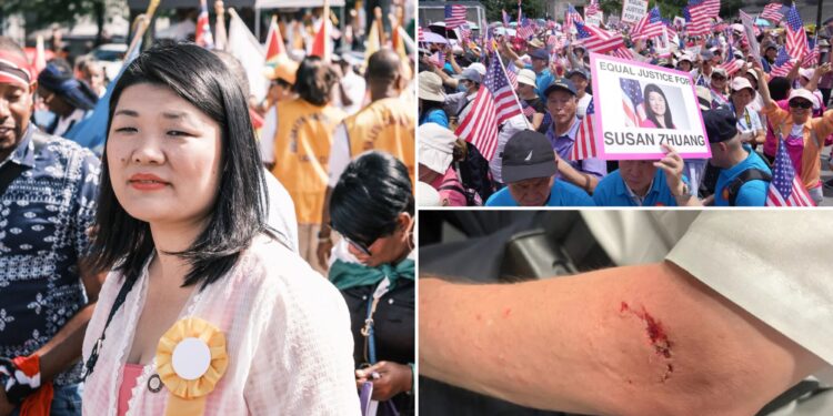 NYC councilwoman who infamously bit cop's arm creates defense fund to offset legal bills