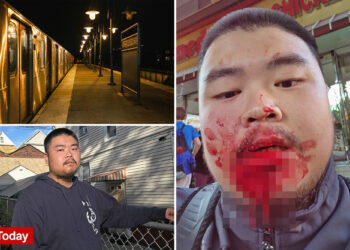 'Felt like it was a knife'