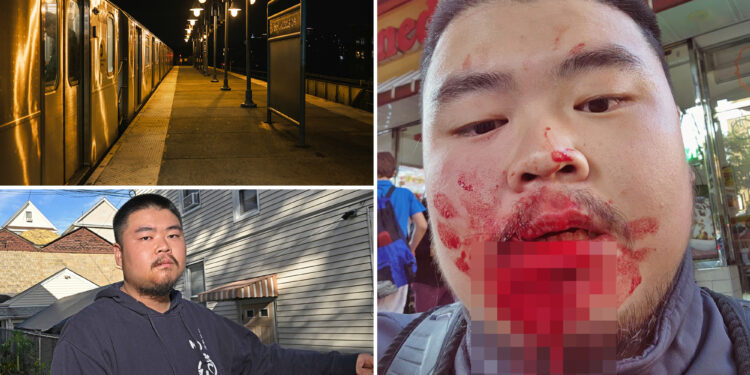 'Felt like it was a knife'