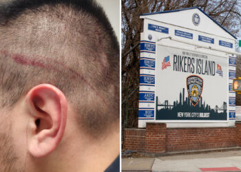 NYC correction officers union calls for firing of security chief after another slashing at Rikers