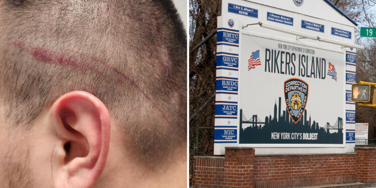 NYC correction officers union calls for firing of security chief after another slashing at Rikers