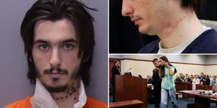 Spencer Pearson shows scars from Madison Schemitz stabbing as he's sentenced to life