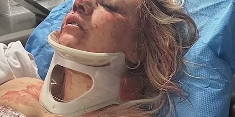 Woman named Canada Rinaldi in hospital bed with neck brace, recovering from violent assault