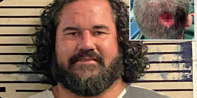 Florida man sentenced for biting cop's head at music festival