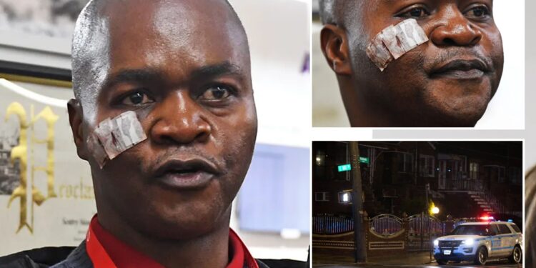 NYC cab driver lucky to be alive after shooting in attempted robbery