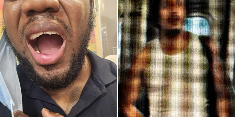 MTA drivers fears return to worker after punch by stranger