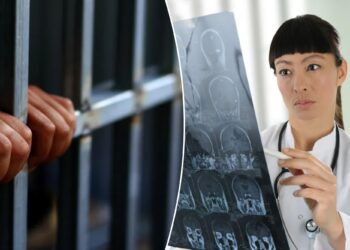 Surprising, controversial link between brain injuries, crime