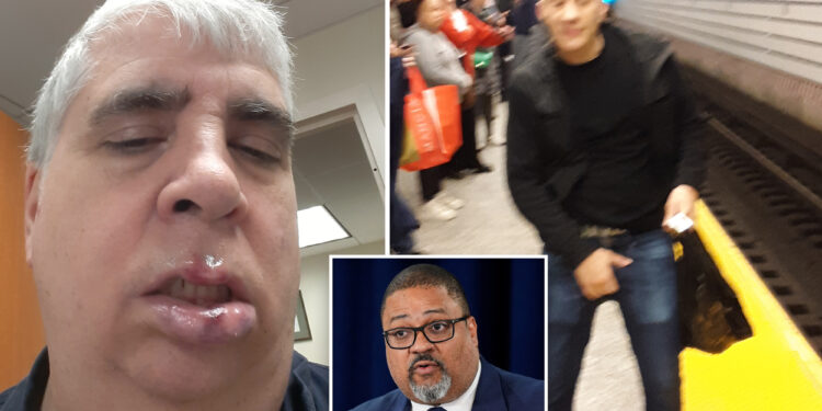 Straphanger whose attacker walked free warns of Mamdani mayoralty