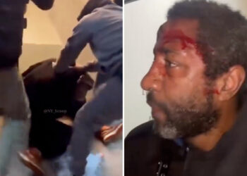 Brooklyn spitter left bloodied by two men 'tired' of his vile antics
