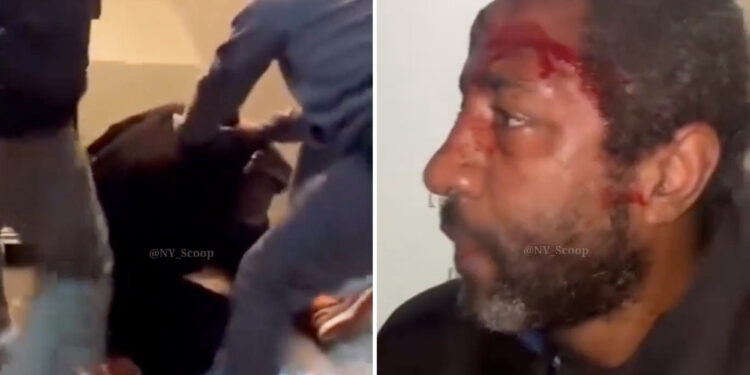 Brooklyn spitter left bloodied by two men 'tired' of his vile antics