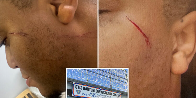 Two NYC Correction officers attacked in 4 hours at same Rikers jail -- one by menace accused of brutal subway assault: union